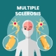 Multipla skleroza